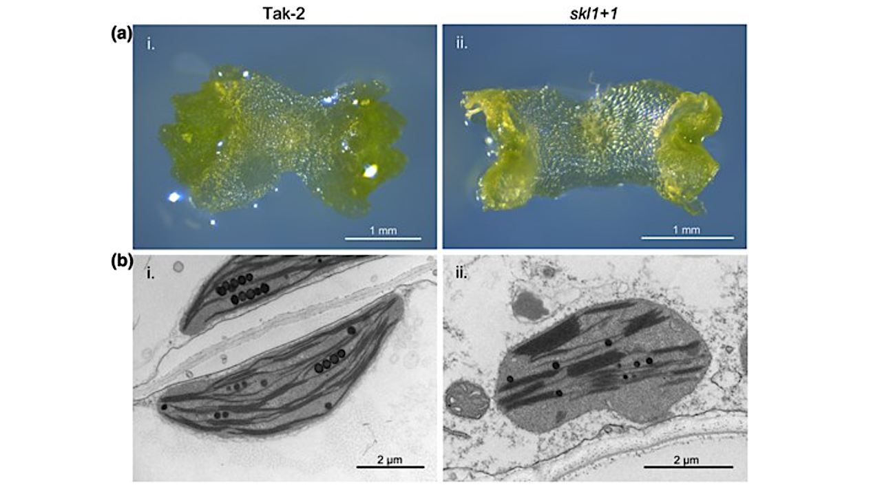 Researchers Identify Protein That Evolved To Enable Photosynthesis In Land Plants