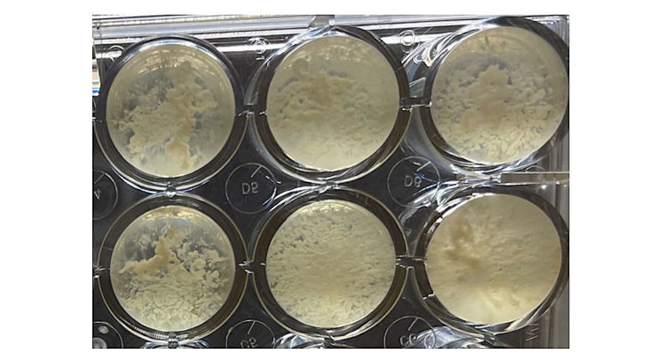 Tersicoccus phoenicis Microbes Found In A Spacecraft Clean Room Exhibits Dormancy