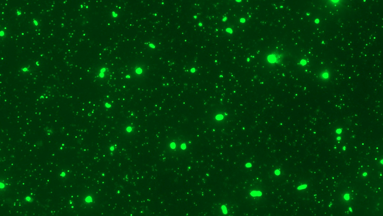 Viruses in Polar Oceans Follow Rhythms Of Earth’s Seas