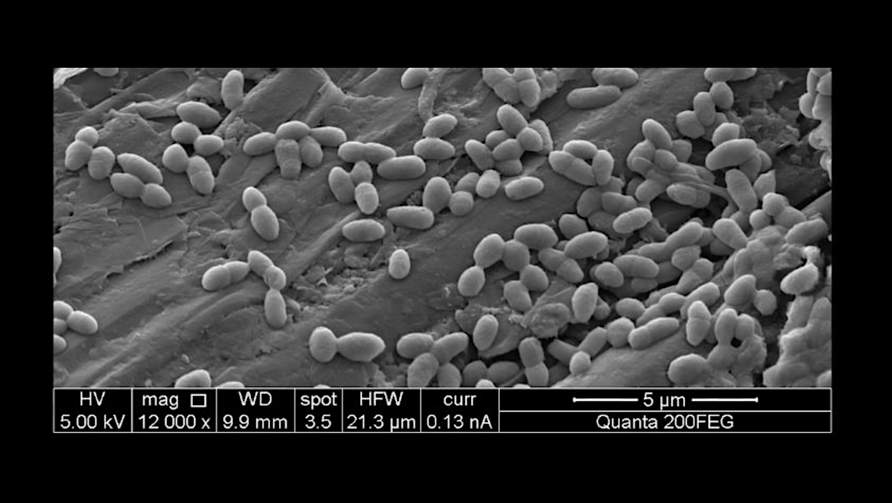 Bacteria Reveal Hidden Powers Of Electricity Transfer