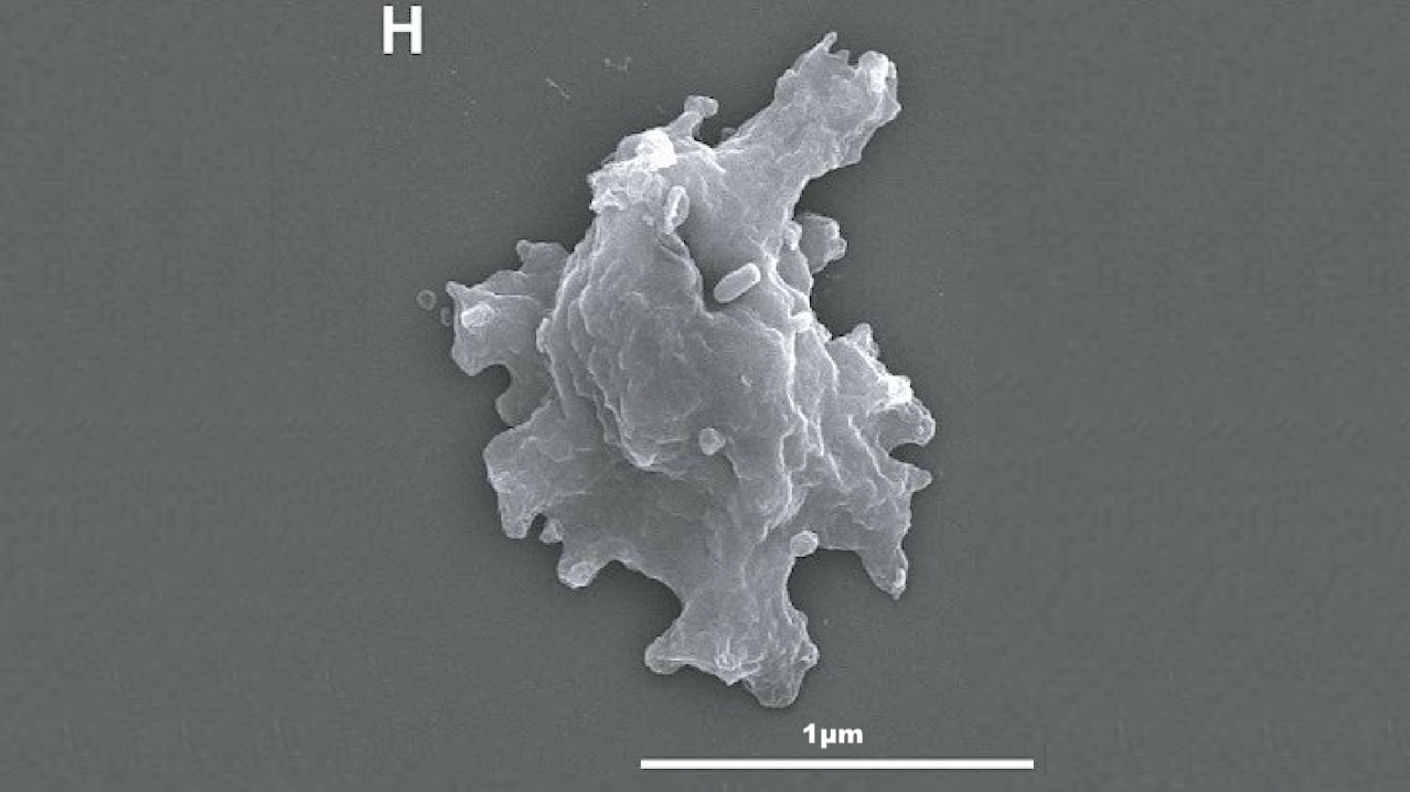 A Geothermal Amoeba Sets A New Upper Temperature Limit For Eukaryotes