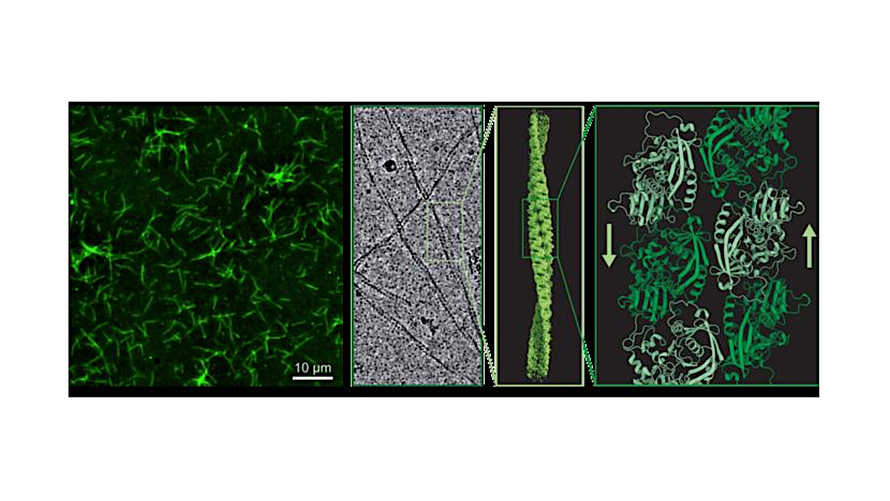 Anabaena Learns A New Trick – Cyanobacteria Surprise Scientists With Evolutionary Shift
