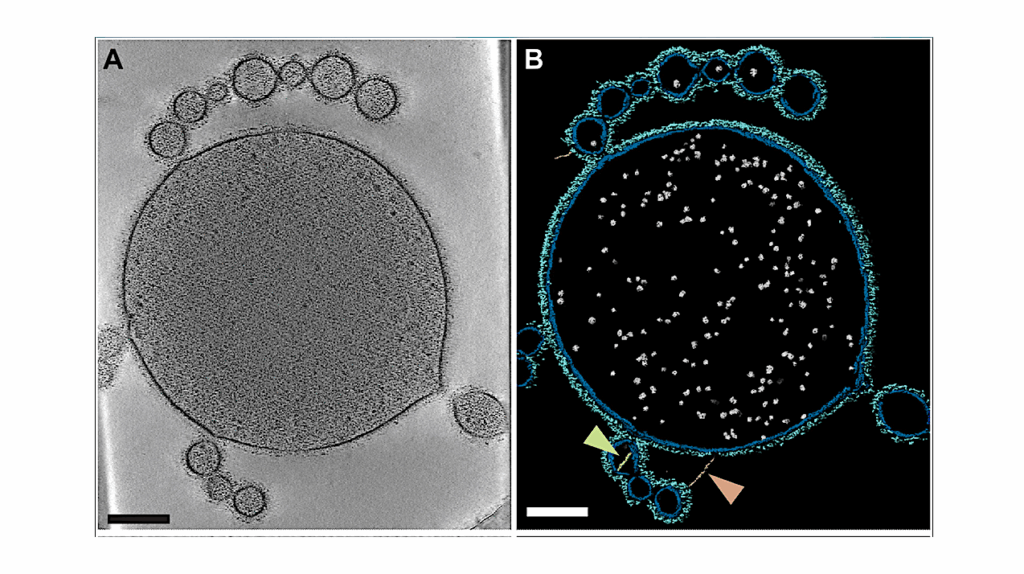 From Asgard to Earth: Tiny Discoveries Hold Clues To Life’s Greatest Leap