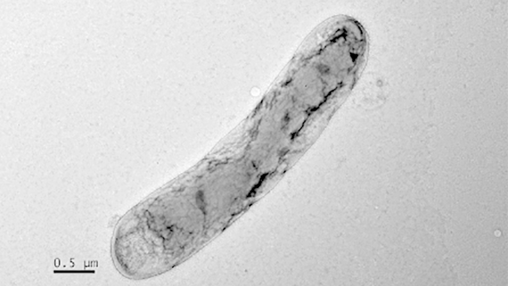 Phreatobacter aquiterrae sp. nov., Isolated From An Icelandic Subsurface Geothermal Aquifer